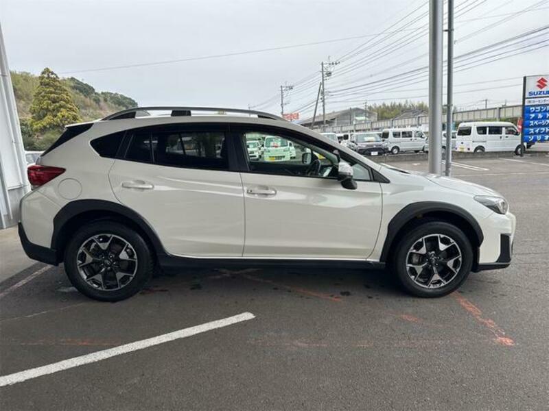 XV