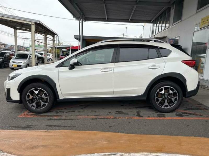 XV