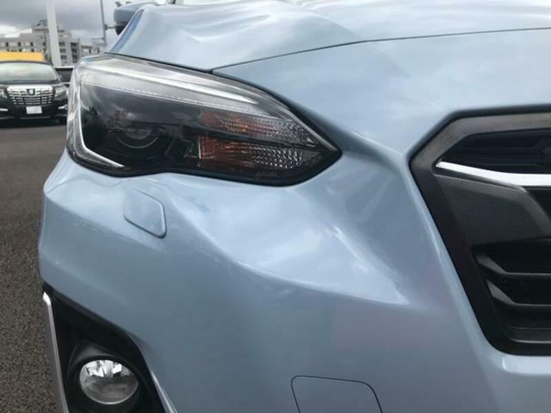 XV