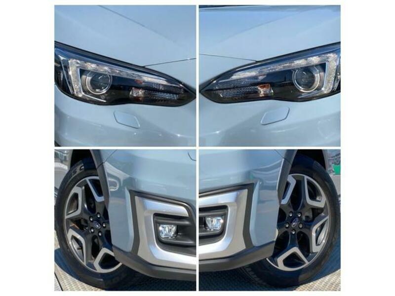 XV