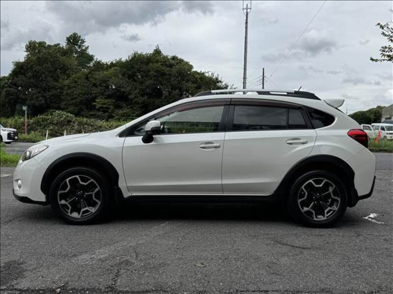 XV