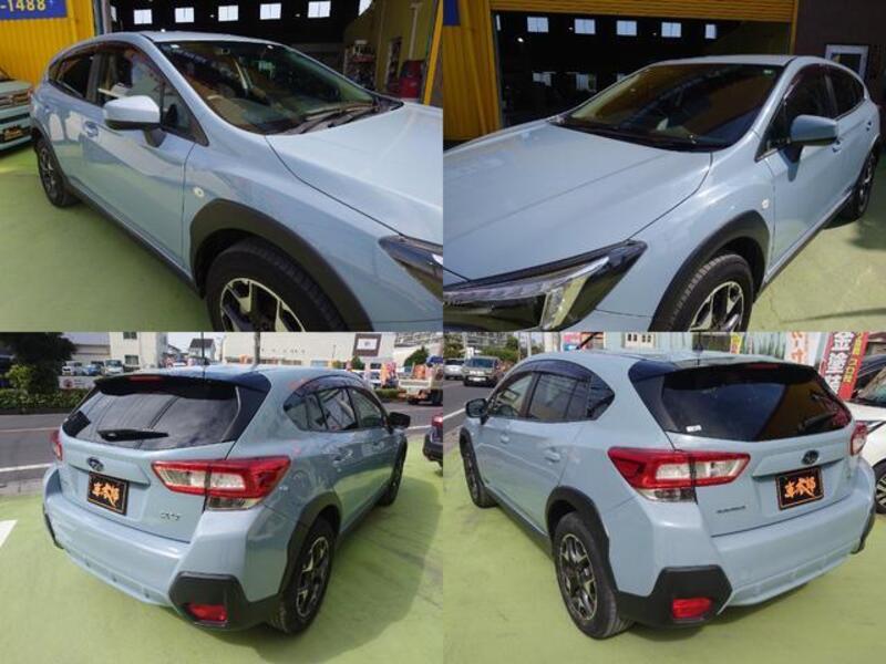 XV